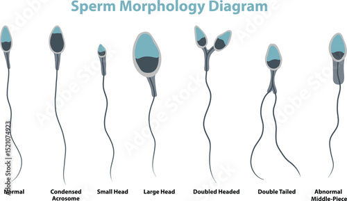 illustration of sperm morphology diagram