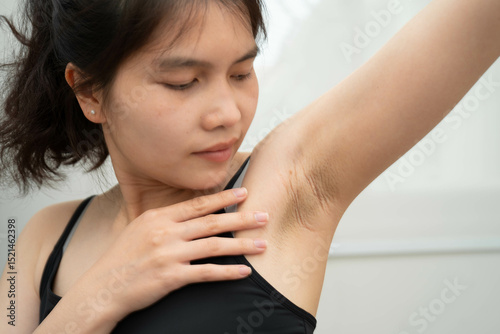 Asian woman have problem black armpit beauty skin care.