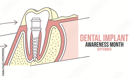Dental implant awareness month. Teeth implant concept Design.