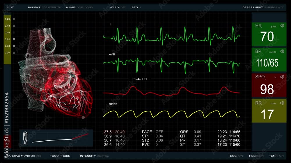 Emergency Room Cardiac Monitor Displaying Vital Signs and Heart ...