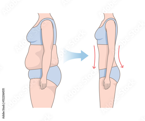 Women's body changes before and after fitness. Woman's body with fat belly and slender beautiful figure. Weight loss comparison