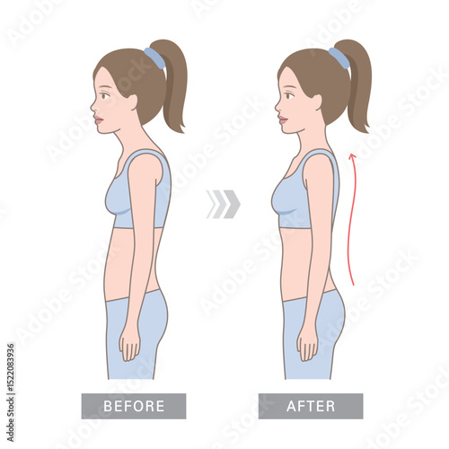 Curved human spine and back. A sideways woman standing with a curved waist, text neck, and stooped posture. Female figures with rounded shoulders.