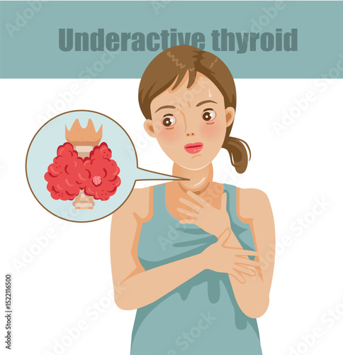 Illustration of Woman with Thyroid Problem