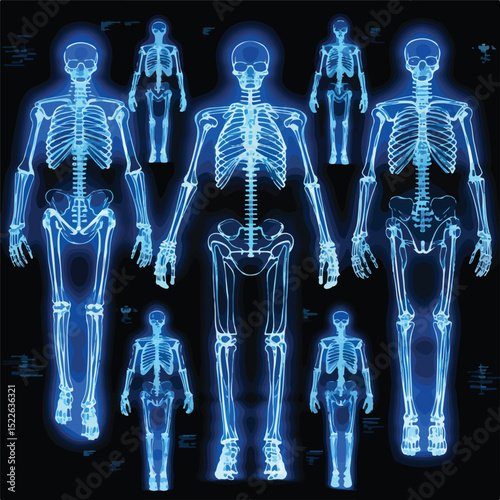 Detailed Xray Bones Images with Blue Lines Stock Vector for Medical Professionals