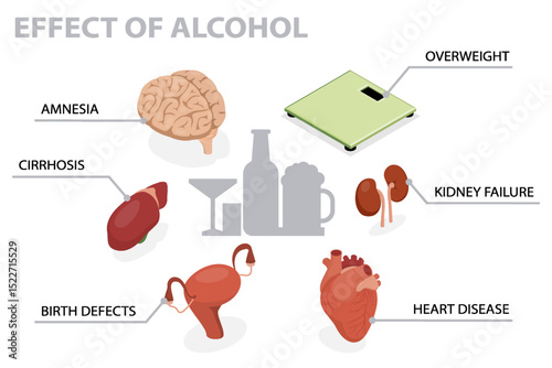 Effects of alcohol on human body, infographic. Alcoholism disease health care concept. 3d flat isometric vector illustration.