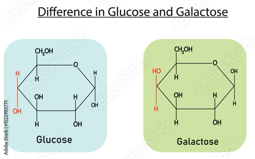 Structural Differences Between Glucose and Galactose: A Monosaccharide Chemical Diagram for Medical Education