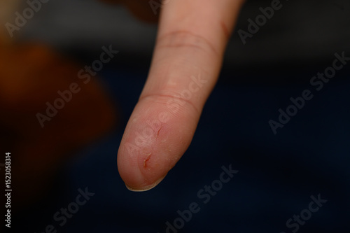 Injured woman showing a bleeding finger cut, possibly from a kitchen knife.