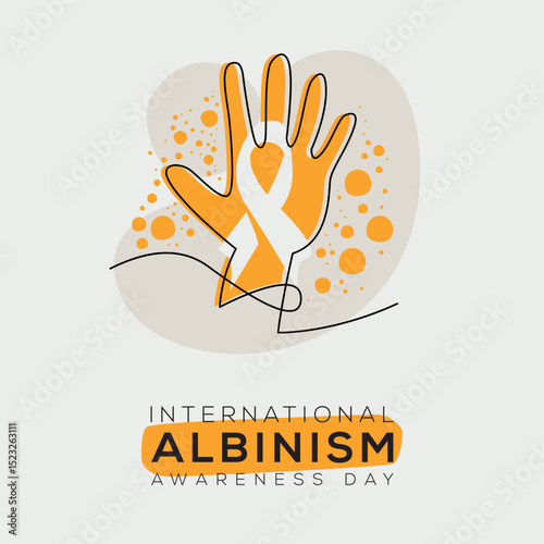 International Albinism Awareness Day, held on 13 June.