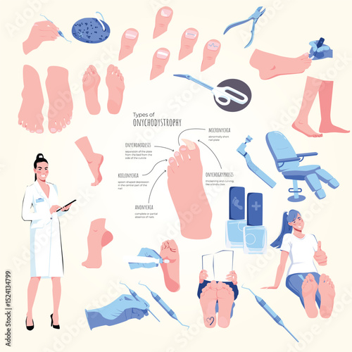 Podiatry foot disease flat set of isolated icons with human feet medical supplies and text captions vector illustration