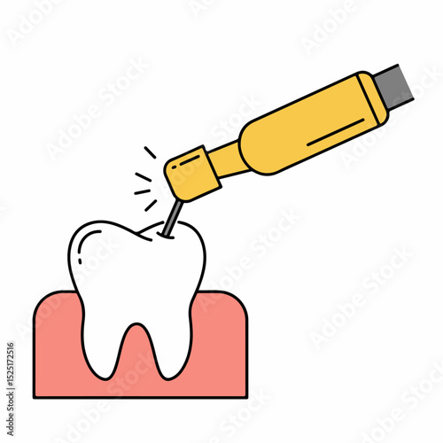 Dental drill working on tooth. Tooth enamel being treated with modern dental instrument. Detailed illustration of dental procedure for informative materials. This image is perfect for dental clinics,