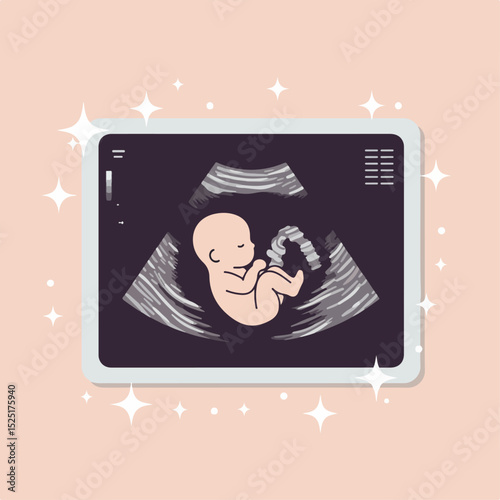 Ultrasound image showing fetus, baby in womb, pregnancy scan. Detailed medical illustration of a developing baby inside mother's uterus.  High-quality image ideal for educational materials, brochures,