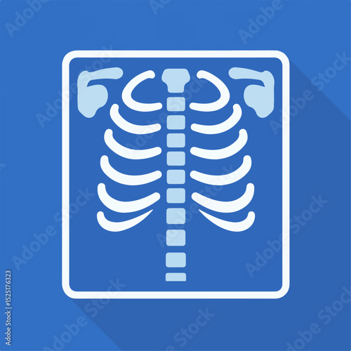 Chest x ray image showing ribs, spine, and clavicles.  Detailed medical illustration of human skeleton bones in chest area. High quality x ray for medical publications, educational materials,