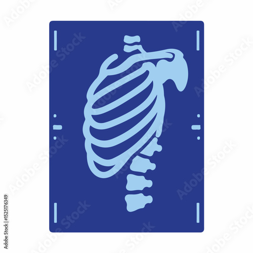 Detailed x ray image of human rib cage and spine. Medical scan shows bone structure, including ribs, vertebrae, and clavicle. This high resolution image is ideal for medical publications,