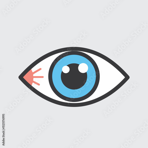 Human eye with inflammation in corner. Detailed illustration of eye anatomy showing redness and irritation.