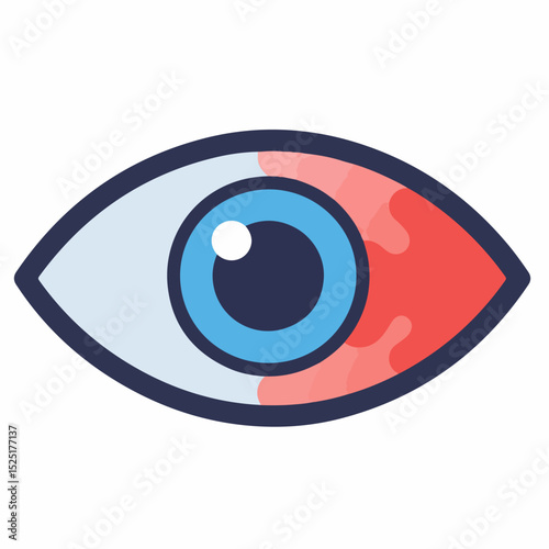 Red eye inflammation illustration.  Detailed medical illustration showing bloodshot eye with redness and irritation.  This graphic is perfect for ophthalmology or traumatology educational materials.