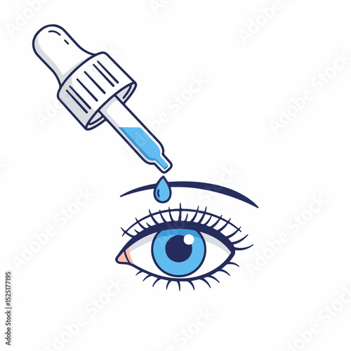 Eye drops application illustration. Detailed eye with eyelashes and eyebrow. Pipette dispensing liquid.  Medical illustration perfect for ophthalmology or traumatology educational materials.