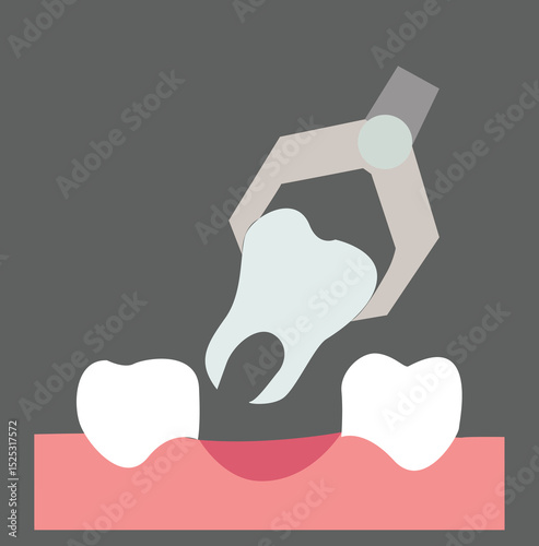 pull out a tooth. Tooth extraction illustration