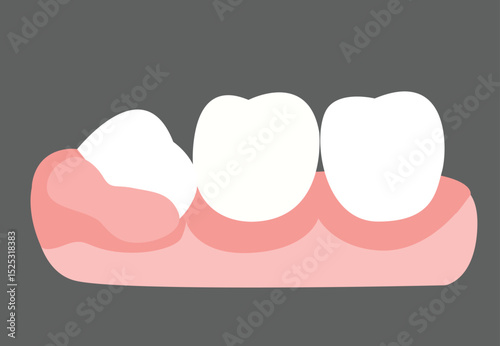 Wisdom tooth icon. Crooked teeth linear