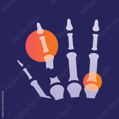 Hand fracture glassmorphism illustration.