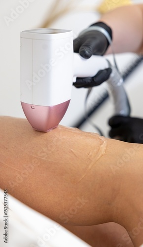 Laser hair removal at the beautician