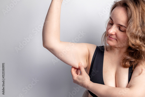 Schilderij op canvas A young woman grabbing skin on her upper arm with excess fat isolated on a white background