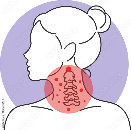 Medical illustration of woman with severe pain in cervical spine