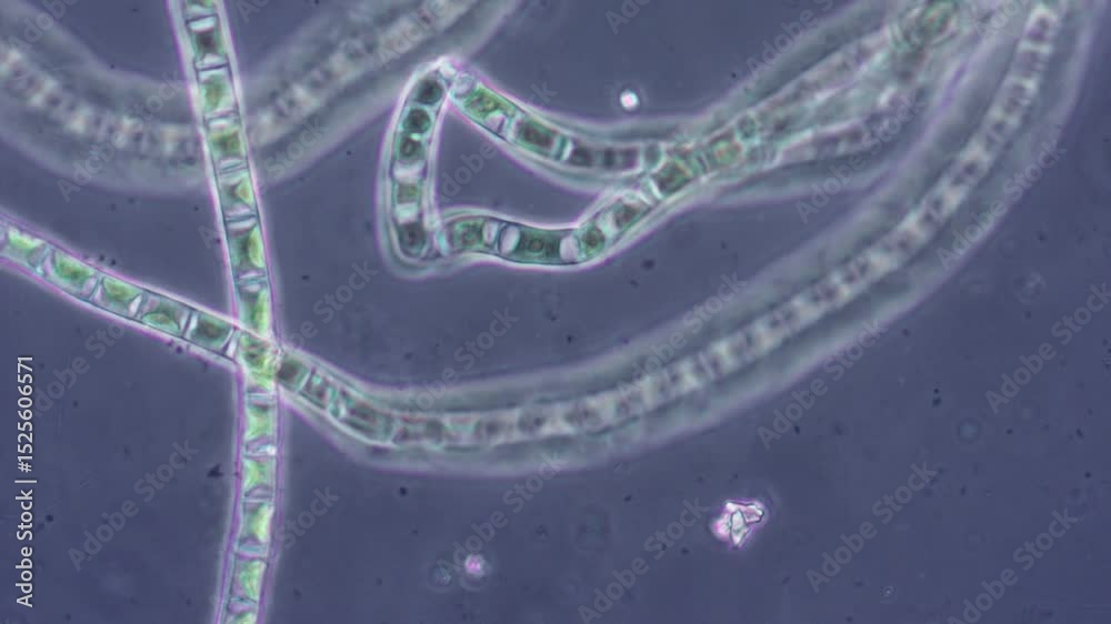 When magnified under a microscope, filamentous algae show individual cells with nuclei and vacuoles, green chloroplasts.