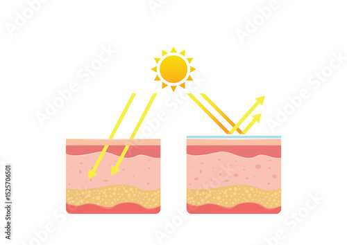 Uv skin protection. Damaged human skin peels before and after sun protection body adipose layers epidermis recent vector infographic template. Uv sunburn, ultraviolet to body damage illustration