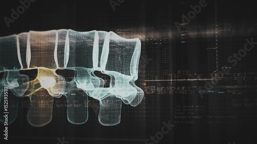 Futuristic biomedical concept with advanced holographic scanning and HUD diagnosing spinal disc herniation using 3D holograms of a patient’s backbone, AR, and real-time medical imaging