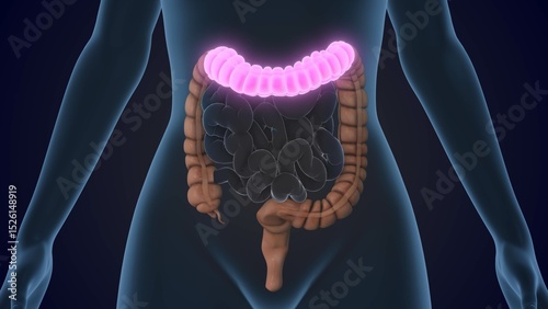 The Sigmoid colon is a section of the large intestine photo