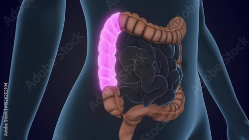 The Ascending colon is a section of the large intestine