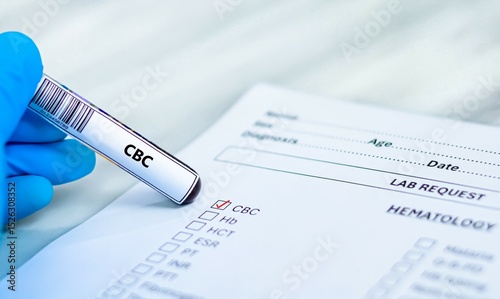 Blood sample tube and paper reqeust order for complete blood count (CBC) test analysis.