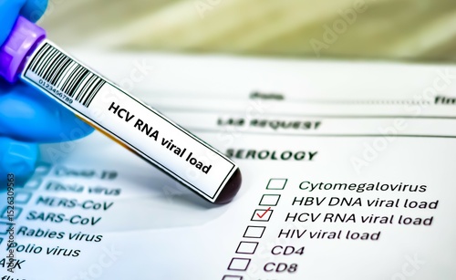 Blood sample tube and paper order request for HCV RNA viral load test analysis.