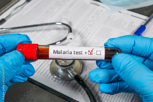 Doctor holding test tube showing positive result for malaria