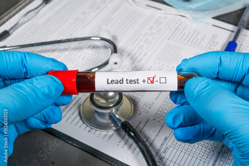 Doctor holding blood sample for lead test: positive result