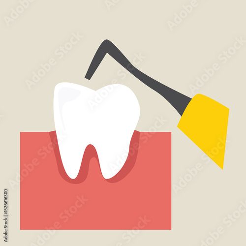 cleaning tartar.teeth scaling, dental plaque removal for cleaning 
