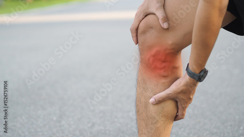 Varicose veins on the legs of men