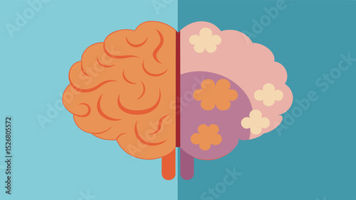 Panel 13 A comparison of a normal brain and a brain with Alzheimers disease showing significant shrinkage and loss of brain tissue. Caption Effects of Alzheimers Disease. Vector illustration