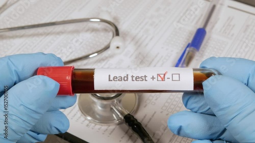 Doctor holding blood sample with positive lead test result