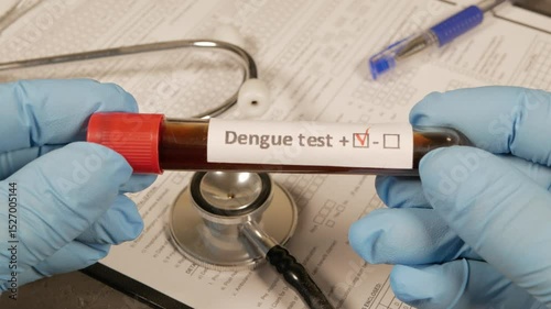 Doctor holding positive dengue test tube
