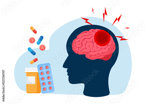 Illustration of Brain with Pain Symbol Highlighting Headache or Migraine stock illustration