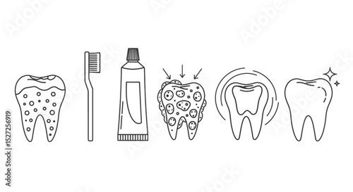 Understanding Tooth Decay Process A Comprehensive Guide to Preventing Cavities and Maintaining Optimal Dental Health Naturally and Effectively Today