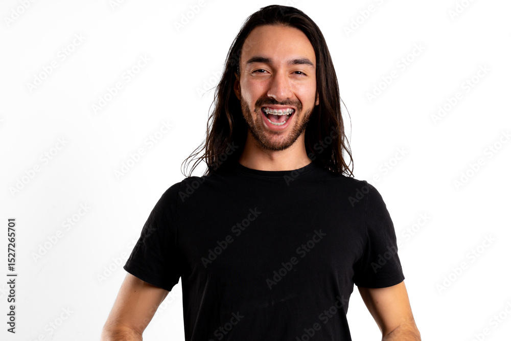 Fototapeta premium Smiling happily with braces and open mouth, young Latin man looks at camera against white background