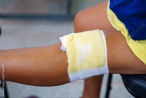 Knee pain in an elderly person use thai herbal compress ball or herbal on knee. Knee pain may cause from muscle strain, tendinosis, Knee osteoarthritis. Thai traditional medicin