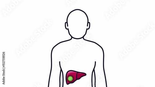 Person and Hepatitis Liver Animation Video on transparent background
