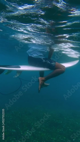Video of male surfer sitting on his surfboard in ocean at cloudy day. Wide angle underwater view. Vertical video