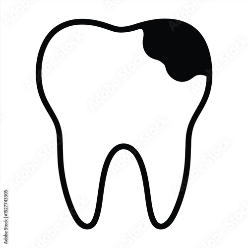 Decayed Tooth: Simple yet poignant illustration of a decayed molar, revealing the effects of poor oral health.
