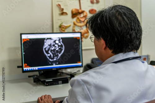 Healthcare professional viewing patient scan image on monitor. Advanced radiological tools in use for disease analysis. Conceptual photo of modern diagnostics and medical consultation process.