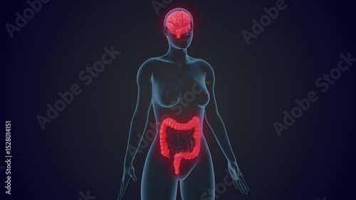 Irritable Bowel Syndrome Triggered by Prolonged Emotional and Mental Stress