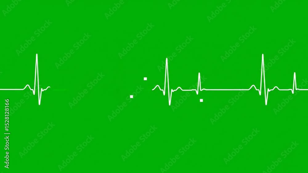 Medical heart rate graph on green background